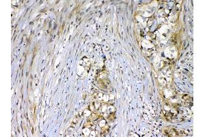 IHC analysis of VEGF Receptor 2  using anti-VEGF Receptor 2  antibody .