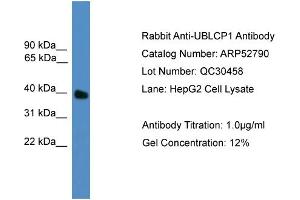 WB Suggested Anti-UBLCP1  Antibody Titration: 0. (UBLCP1 anticorps  (N-Term))