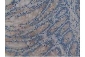IHC-P analysis of Mouse Large Intestine Tissue, with DAB staining. (REG3B anticorps  (AA 27-175))