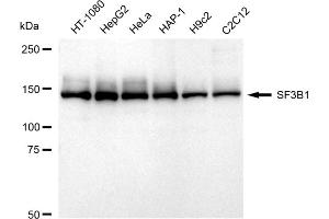 Western blotting analysis using SF3B1 antibody (ABIN7800424).