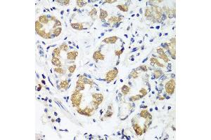 Immunohistochemistry of paraffin-embedded human stomach using OXCT1 antibody at dilution of 1:100 (40x lens). (OXCT1 anticorps)