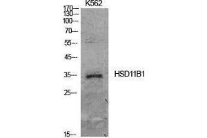 Western Blotting (WB) image for anti-Hydroxysteroid (11-Beta) Dehydrogenase 1 (HSD11B1) (Internal Region) antibody (ABIN3181414) (HSD11B1 anticorps  (Internal Region))