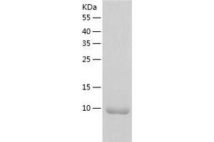 Western Blotting (WB) image for Late Endosomal/lysosomal Adaptor, MAPK and mTOR Activator 4 (LAMTOR4) (AA 1-99) protein (His-IF2DI Tag) (ABIN7123719)