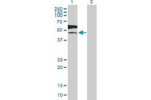 Western Blot analysis of PKLR expression in transfected 293T cell line by PKLR MaxPab polyclonal antibody. (PKLR anticorps  (AA 1-574))