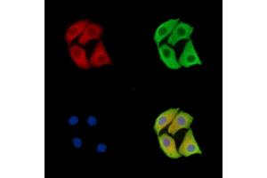 ABIN7096364 and ABIN7100427 staining Hela cells by IF/ICC. (LMAN2 anticorps)