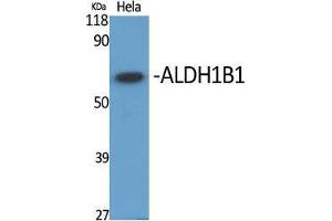 Western Blot (WB) analysis of specific cells using ALDH1B1 Polyclonal Antibody. (ALDH1B1 anticorps  (Internal Region))