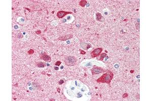 Anti-CCDC60 antibody IHC staining of human brain, cortex.
