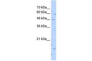 SLC22A23 antibody used at 1 ug/ml to detect target protein. (SLC22A23 anticorps  (Middle Region))