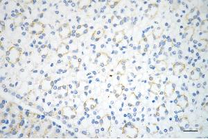 anti-ADAM Metallopeptidase Domain 17 (ADAM17) antibody