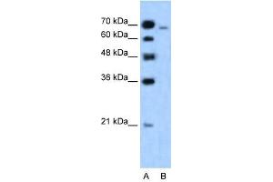 Western Blot showing MLLT4 antibody used at a concentration of 1-2 ug/ml to detect its target protein. (Afadin anticorps  (N-Term))