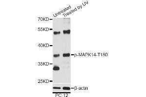 Western blot analysis of extracts of PC-12 cells, using Phospho-MAPK14-T180 antibody (ABIN5969910) at 1/2000 dilution. (MAPK14 anticorps  (pThr180))