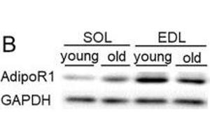 Expression level of adiponectin and adiponectin receptors in soleus (SOL) and extensor digitorum longus (EDL) muscles of young and old mice.
