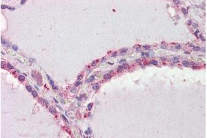 ABIN184667 (2. (DAPK2 anticorps  (C-Term))