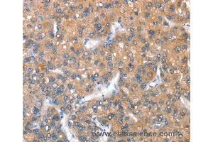 Immunohistochemistry of Human brain  using KEL Polyclonal Antibody at dilution of 1:40 (KEL anticorps)