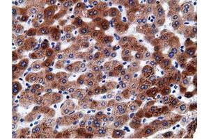 Immunohistochemical staining of paraffin-embedded Human liver tissue using anti-CD80 mouse monoclonal antibody. (CD80 anticorps)