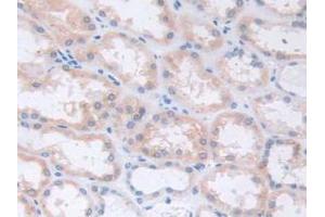 IHC-P analysis of Human Kidney Tissue, with DAB staining. (S100A5 anticorps  (AA 1-92))