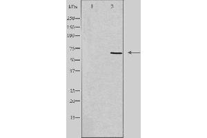 Western blot analysis of extracts from HeLa cells using ADCK5 antibody. (ADCK5 anticorps  (N-Term))