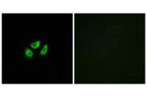 Immunofluorescence analysis of A549 cells, using SCN7A antibody.