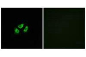 Immunofluorescence analysis of A549 cells, using SCN7A antibody. (SCN7A anticorps)