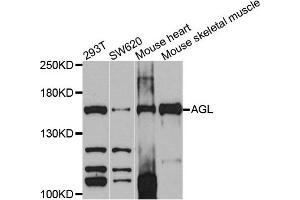 Western blot analysis of extracts of various cells, using AGL antibody. (AGL anticorps)