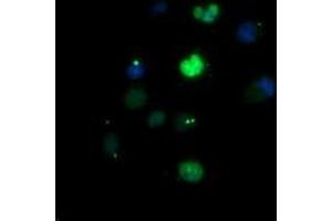 Image no. 1 for anti-Early Growth Response 2 (EGR2) (AA 156-476) antibody (ABIN1490983) (EGR2 anticorps  (AA 156-476))