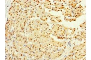 Immunohistochemistry of paraffin-embedded human pancreatic tissue using ABIN7160672 at dilution of 1:100 (GALK2 anticorps  (AA 161-458))