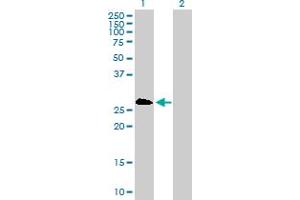 Western Blot analysis of PSMB8 expression in transfected 293T cell line by PSMB8 MaxPab polyclonal antibody.
