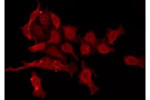 ABIN6274427 staining HepG2 by IF/ICC. (CAMKV anticorps  (Internal Region))