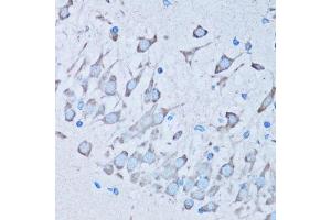 Immunohistochemistry of paraffin-embedded mouse brain using NNMT antibody. (NNMT anticorps  (AA 1-264))