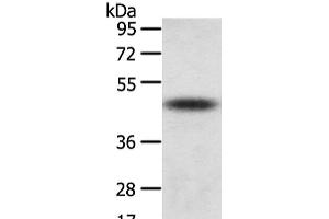 TTC23 anticorps