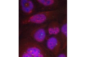 Immunofluorescence (IF) image for anti-Nuclear Factor-kB p65 (NFkBP65) (pSer276) antibody (ABIN1682005)
