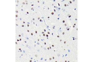 Immunohistochemistry of paraffin-embedded rat brain using BRG1/SM antibody (ABIN7270655) at dilution of 1:100 (40x lens). (SMARCA4 anticorps)