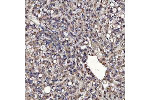 IHC analysis of TOM1L1 using anti-TOM1L1 antibody (ABIN7602631). (TOM1L1 anticorps  (AA 9-448))