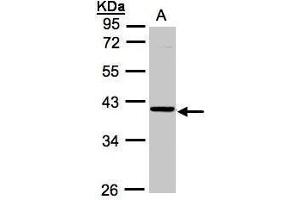 WB Image Sample (30μg whole cell lysate) A:A431, 10% SDS PAGE antibody diluted at 1:1000 (ASB4 anticorps)