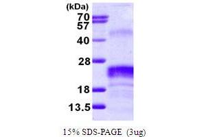 VEGF 165 (AA 207-371) protein (His tag)