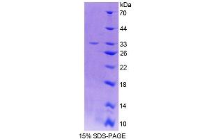 SDS-PAGE analysis of Rat THYN1 Protein. (THYN1 Protéine)