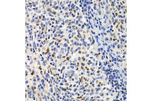 Immunohistochemistry of paraffin-embedded human lymphonodus using GEMIN2 Antibody (ABIN1872798) at dilution of 1:200 (40x lens). (SIP1 anticorps)