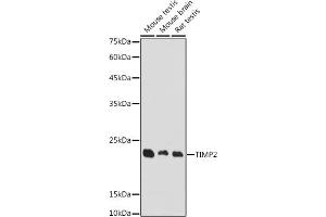Western blot analysis of extracts of various cell lines, using TIMP2 antibody (ABIN7268483) at 1:1000 dilution. (TIMP2 anticorps  (AA 100-200))