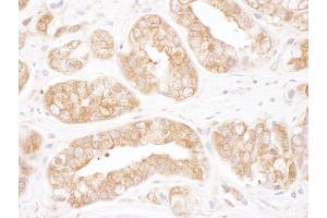 Immunohistochemistry (IHC) image for anti-T-Complex 1 (TCP1) (AA 506-556) antibody (ABIN7454917)