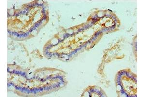 Immunohistochemistry of paraffin-embedded human small intestine tissue using ABIN7168003 at dilution of 1:100 (ROCK2 anticorps  (AA 1109-1388))