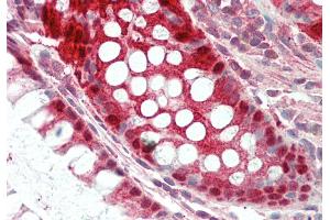 Rabbit Anti-Egln2 antibody  Formalin Fixed Paraffin Embedded Tissue: Human Colon Primary antibody Concentration: 1:100 Secondary Antibody: Donkey anti-Rabbit-Cy3 Secondary Antibody Concentration: 1:200 Magnification: 20x Exposure Time: 0.