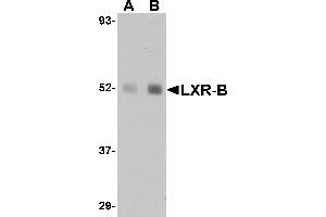 Western blot analysis of LXR-B in human lung tissue lysate with LXR-B antibody at (A) 1 and (B) 2 µg/mL. (NR1H2 anticorps  (N-Term))