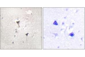 Immunohistochemistry analysis of paraffin-embedded human brain tissue, using PKD1/PKC mu (Ab-205) Antibody.