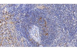 Detection of FTH in Human Spleen Tissue using Monoclonal Antibody to Ferritin, Heavy Polypeptide (FTH)