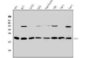 Western blot analysis of HP1 gamma using anti-HP1 gamma antibody (ABIN5693033). (CBX3 anticorps  (AA 2-183))