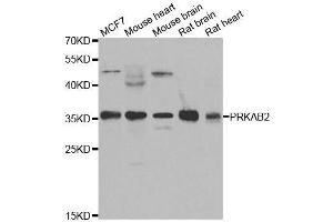 Western blot analysis of extracts of various cell lines, using PRKAB2 antibody.