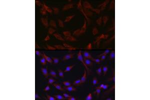 Immunofluorescence analysis of C6 cells using cI Rabbit pAb (ABIN1678920, ABIN3015349, ABIN3015350 and ABIN6213998) at dilution of 1:50 (40x lens).