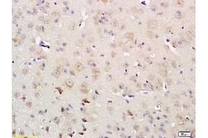 Formalin-fixed and paraffin embedded rat brain labeled with Rabbit Anti IRS-4 Polyclonal Antibody, Unconjugated (ABIN726020) at 1:200 followed by conjugation to the secondary antibody and DAB staining (IRS4 anticorps  (AA 401-500))