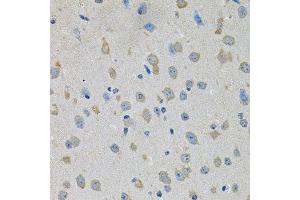 Immunohistochemistry of paraffin-embedded mouse brain using PTK7 antibody.