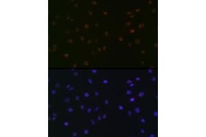 Immunofluorescence analysis of C6 cells using SUPT5H/SPT5 Rabbit mAb (ABIN7270878) at dilution of 1:100 (40x lens). (SUPT5H anticorps)